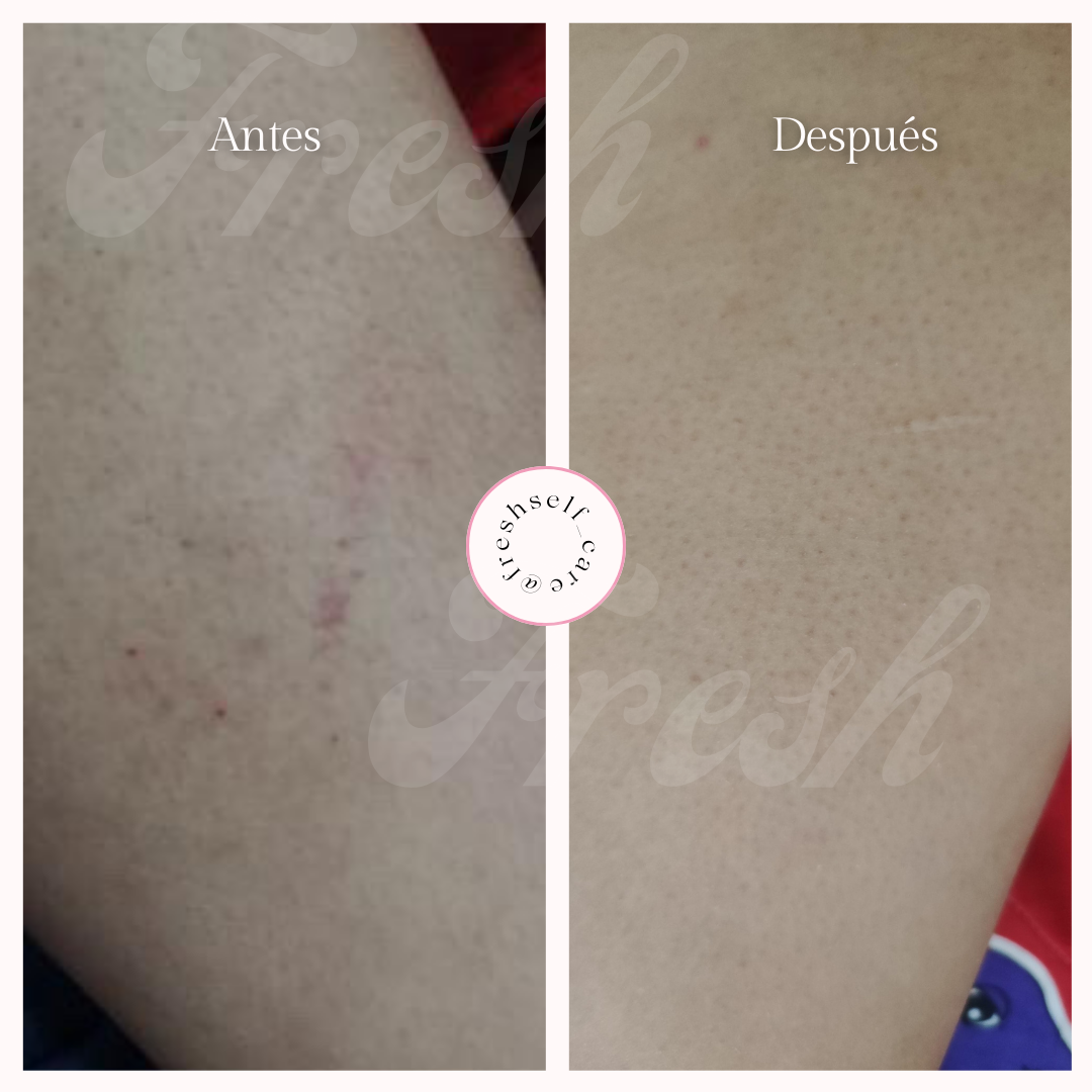 Crema calmante reparadora