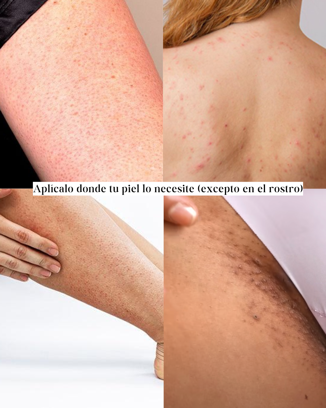 Crema calmante reparadora