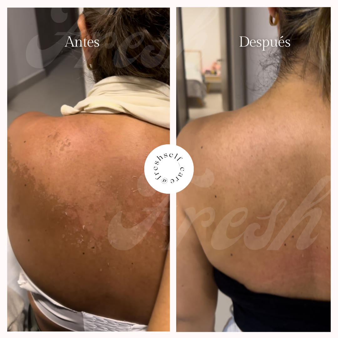 Exfoliante Premium