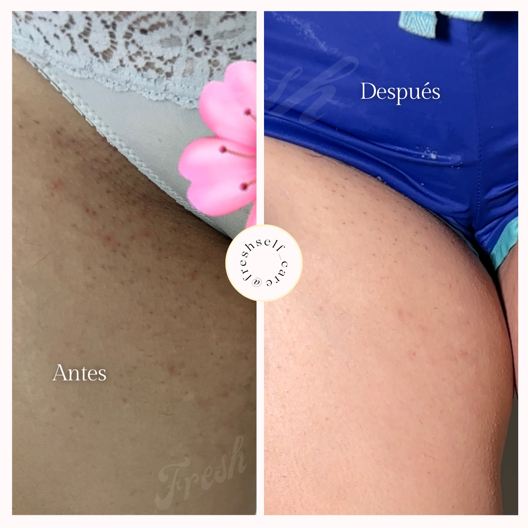 Exfoliante y Calmante KIT PIEL DE SEDA