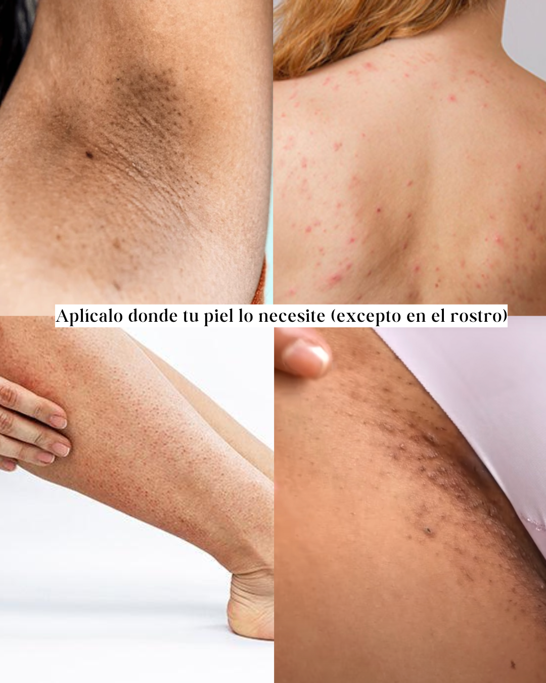 Exfoliante,Aclarante y Calmante KIT PIEL SANA