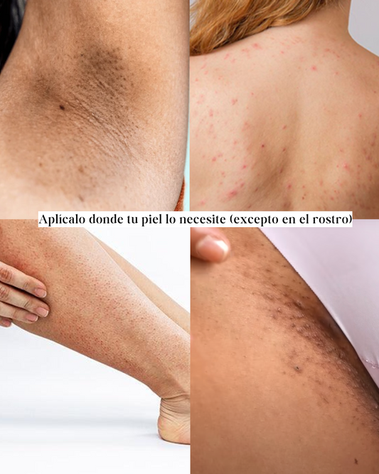 Exfoliante,Aclarante y Calmante KIT PIEL SANA