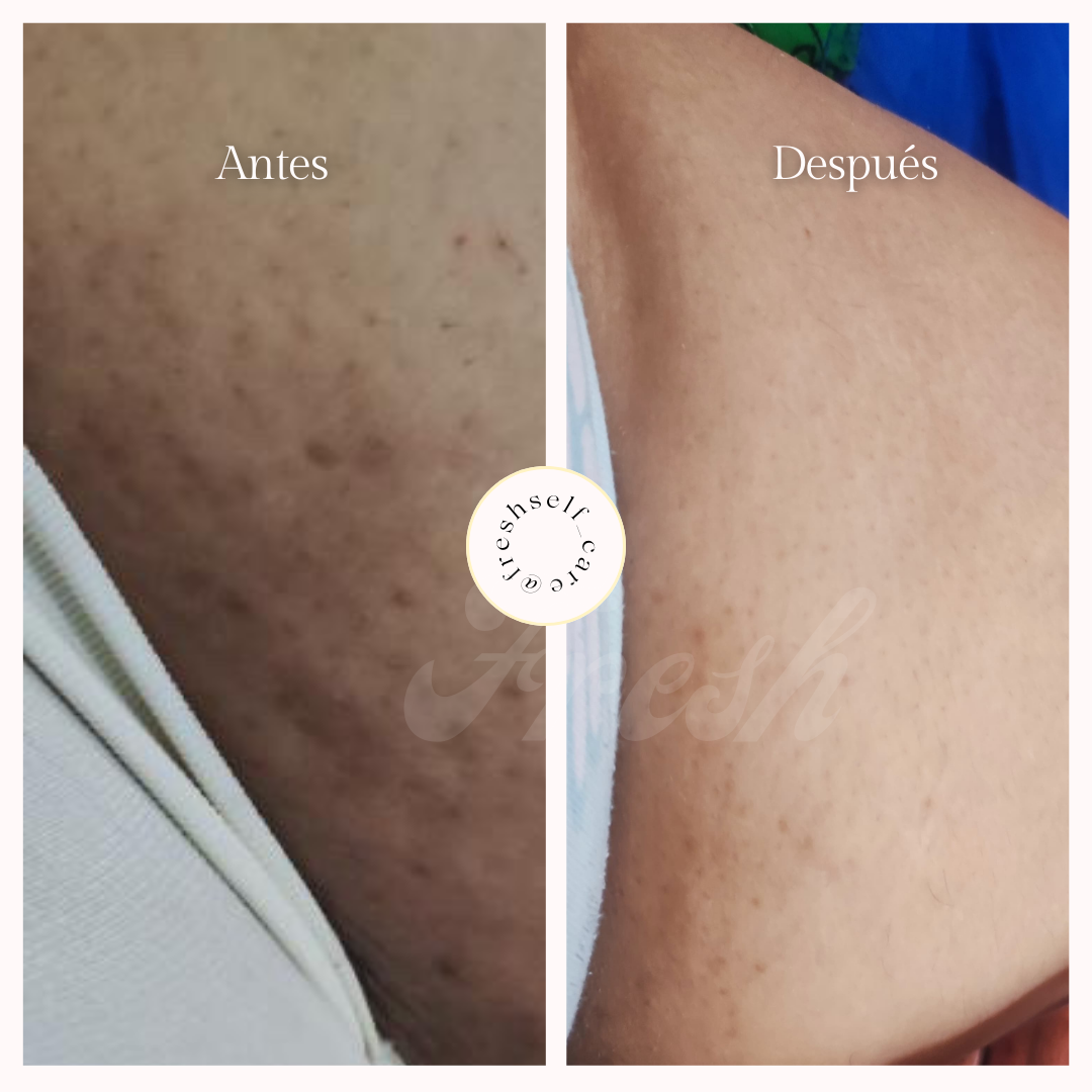 Exfoliante y Calmante KIT PIEL DE SEDA