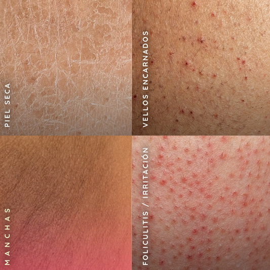 Exfoliante y Calmante KIT PIEL DE SEDA